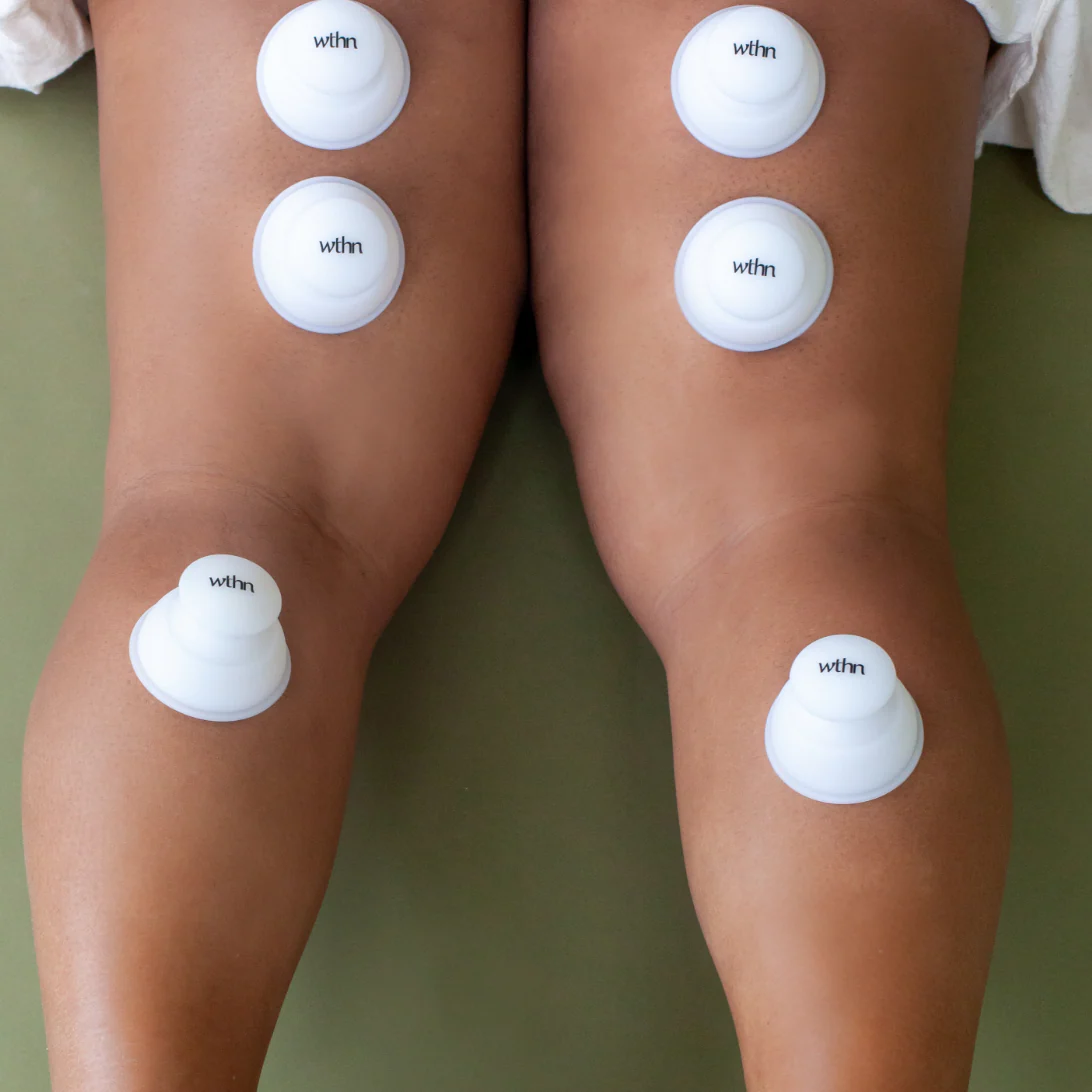 Body Cupping Kit - Image 3